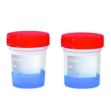 150ml (мл) контейнери для збору зразків сечі з ПП, градуювання, стерильні